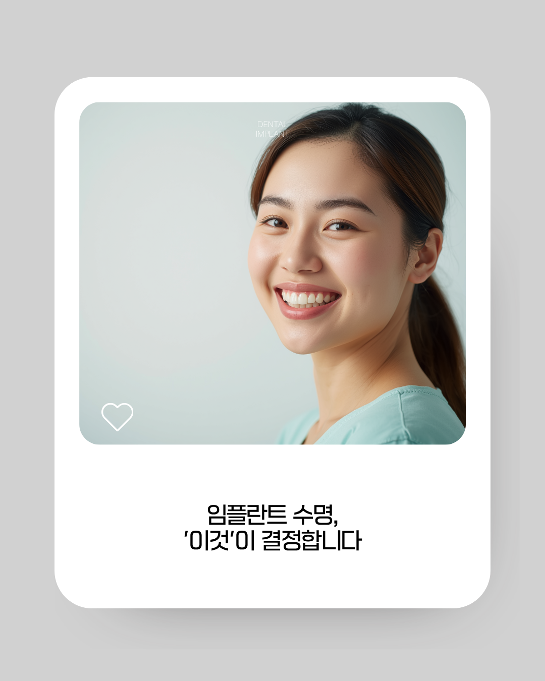 임플란트 카드뉴스
